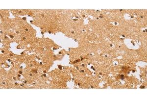 Immunohistochemistry of paraffin-embedded Human brain tissue using ACTR2 Polyclonal Antibody at dilution 1:40 (ACTR2 anticorps)