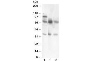 Western blot testing of GAD67 antibody and Lane 1:  rat brain;  2: human HeLa;  3: (h) COLO320.
