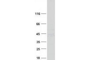 Validation with Western Blot