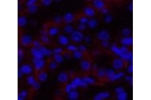 Immunofluorescence analysis of Rat kidney tissue using JAK3 Polyclonal Antibody at dilution of 1:200.