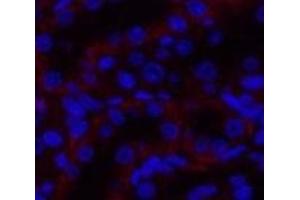Immunofluorescence analysis of Rat kidney tissue using JAK3 Polyclonal Antibody at dilution of 1:200. (JAK3 anticorps)