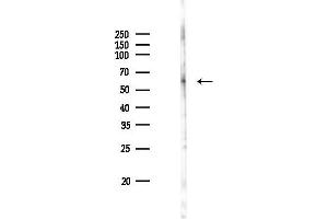 anti-Zinc Finger and BTB Domain Containing 33 (ZBTB33) (N-Term) antibody