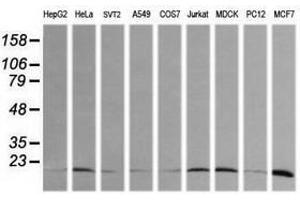 Image no. 2 for anti-HRas proto-oncogene, GTPase (HRAS) antibody (ABIN1498713) (HRAS anticorps)