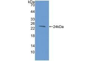 Detection of Recombinant HAVCR2, Human using Polyclonal Antibody to Hepatitis A Virus Cellular Receptor 2 (HAVCR2) (TIM3 anticorps  (AA 22-202))