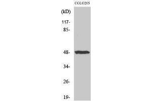 Western Blotting (WB) image for anti-Interleukin 13 Receptor, alpha 1 (IL13RA1) (Ser561) antibody (ABIN3175623) (IL13 Receptor alpha 1 anticorps  (Ser561))