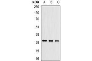 Western blot analysis of UBE2J2 expression in Hela (A), mouse testis (B), mouse brain (C) whole cell lysates.