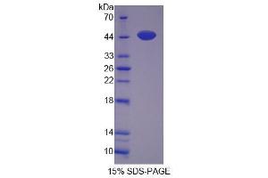 Image no. 1 for Myopalladin (MYPN) (AA 945-1320) protein (His tag) (ABIN4990591) (Myopalladin Protein (MYPN) (AA 945-1320) (His tag))