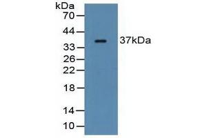 Western blot analysis of Rat Serum. (FCN1 anticorps  (AA 25-279))