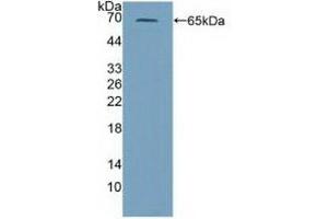Detection of Recombinant PRF1, Mouse using Polyclonal Antibody to Perforin 1 (PRF1) (Perforin 1 anticorps  (AA 40-355))