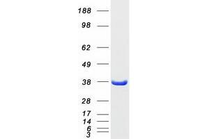 Validation with Western Blot