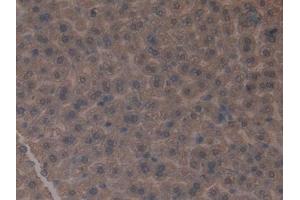 Detection of GLUD1 in Mouse Liver Tissue using Polyclonal Antibody to Glutamate Dehydrogenase 1 (GLUD1)