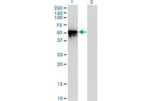 Western Blot analysis of KLF8 expression in transfected 293T cell line by KLF8 monoclonal antibody (M12), clone 3F10. (KLF8 anticorps  (AA 1-98))