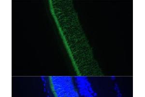 Immunofluorescence analysis of Rat eye using GNGT1 Polyclonal Antibody at dilution of 1:100 (40x lens). (GNGT1 anticorps)