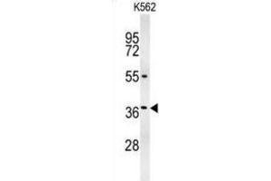 Western Blotting (WB) image for anti-Glucagon-like peptide 1 (GLP-1) antibody (ABIN3002369)