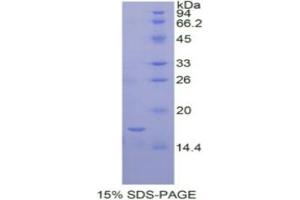 SDS-PAGE analysis of Human IL12Rb2 Protein. (IL12RB2 Protéine)