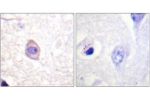 Immunohistochemistry analysis of paraffin-embedded human brain, using Interferon-gamma Receptor alpha (Phospho-Tyr457) Antibody. (IFNGR1 anticorps  (pTyr457))