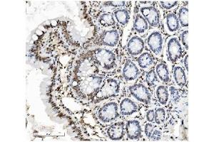 IHC analysis of PTBP1 using anti-PTBP1 antibody (ABIN7599450). (PTBP1 anticorps  (AA 1-504))