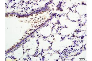 Formalin-fixed and paraffin embedded rat lung labeled with Anti-TNFAIP5/Pentraxin 3 Polyclonal Antibody, Unconjugated (ABIN714686) at 1:200 followed by conjugation to the secondary antibody and DAB staining. (PTX3 anticorps  (AA 151-250))