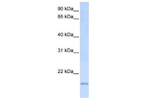 WB Suggested Anti-C20orf30 Antibody Titration:  0. (C20orf30 anticorps  (C-Term))