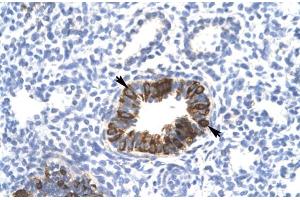 Rabbit Anti-MXI1 Antibody Catalog Number: ARP31403 Paraffin Embedded Tissue: Human Lung Cellular Data: Epithelial cells of bronchiole Antibody Concentration: 4. (MXI1 anticorps  (Middle Region))