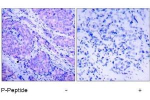 Image no. 1 for anti-3-phosphoinositide Dependent Protein Kinase-1 (PDPK1) (pSer241) antibody (ABIN196617) (PDPK1 anticorps  (pSer241))