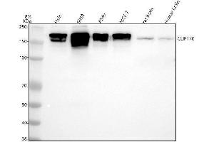 Western blot analysis of CLIP170 using anti-CLIP170 antibody (ABIN7604453).