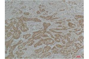 Immunohistochemical (IHC) analysis of paraffin-embedded Mouse Brain Tissue using a-tubulin(Acetyl Lys40) Mouse Monoclonal Antibody diluted at 1:200. (alpha Tubulin anticorps  (acLys40))