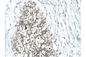 MMP19 antibody was used for immunohistochemistry at a concentration of 4-8 ug/ml to stain Epithelial cells (arrows) in Human Urinary bladder. (MMP19 anticorps  (C-Term))