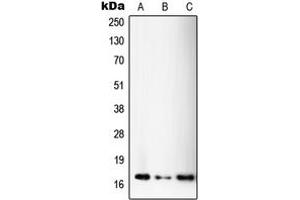 Western blot analysis of SSBP1 expression in A375 (A), HeLa (B), MOLT4 (C) whole cell lysates. (SSBP1 anticorps  (C-Term))
