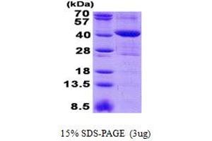 Image no. 1 for Mitochondrial rRNA Methyltransferase 1 Homolog (MRM1) (AA 21-353) protein (His tag) (ABIN1098583)