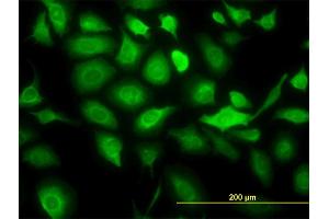 Immunofluorescence of monoclonal antibody to KRT20 on HeLa cell. (KRT20 anticorps  (AA 1-424))