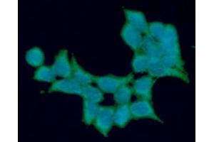 anti-Aldehyde Dehydrogenase 5 Family, Member A1 (ALDH5A1) (AA 48-535) antibody