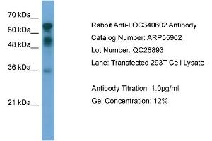 WB Suggested Anti-CXorf67  Antibody Titration: 0. (CXorf67 anticorps  (Middle Region))