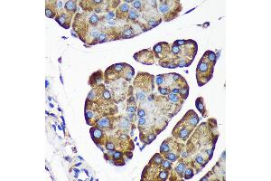 Immunohistochemistry of paraffin-embedded Mouse pancreas using  Rabbit pAb (ABIN7265696) at dilution of 1:100 (40x lens). (ALG5 anticorps  (AA 34-190))