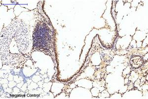 Immunohistochemical analysis of paraffin-embedded rat lung tissue. (EIF4A1 anticorps)