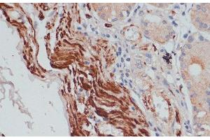 Immunohistochemistry of paraffin-embedded Human stomach using DES Polyclonal Antibody at dilution of 1:100 (40x lens). (Desmin anticorps)