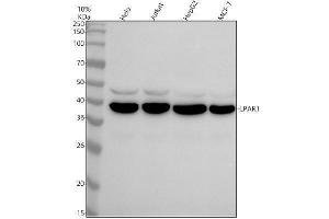 Western blot analysis of LPAR1 using anti-LPAR1 antibody (ABIN7604712).