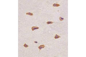 Paraformaldehyde-fixed, paraffin embedded human brain tissue, Antigen retrieval by boiling in sodium citrate buffer (pH6.