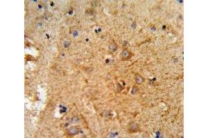 IHC analysis of FFPE human brain tissue stained with PCSK2 antibody