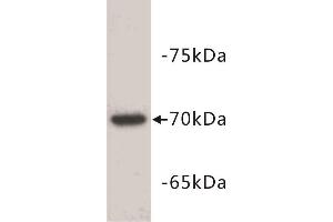 Western Blotting (WB) image for anti-alpha-Fetoprotein (AFP) (C-Term) antibody (ABIN1854824) (alpha Fetoprotein anticorps  (C-Term))