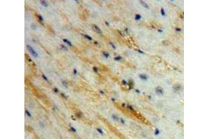 Used in DAB staining on fromalin fixed paraffin-embedded Heart tissue