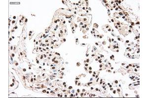 Image no. 5 for anti-Mitogen-Activated Protein Kinase Kinase 4 (MAP2K4) antibody (ABIN1499480)