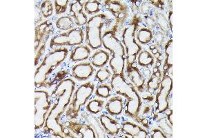 Immunohistochemistry of paraffin-embedded mouse kidney using VD Rabbit pAb (ABIN6130775, ABIN6150077, ABIN6150078 and ABIN6214830) at dilution of 1:25 (40x lens). (VDAC3 anticorps  (AA 1-283))