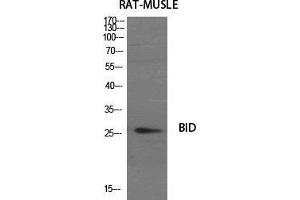 Western Blot (WB) analysis of specific cells using BID Polyclonal Antibody. (BID anticorps  (Internal Region))