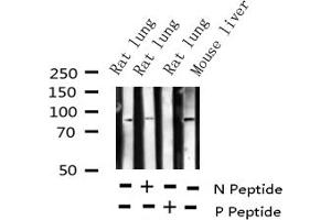 Western blot analysis of Phospho-Cortactin (Tyr421) expression in various lysates