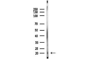 anti-HCG beta (Internal Region) antibody