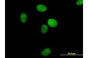 Immunofluorescence of purified MaxPab antibody to XRCC4 on HeLa cell. (XRCC4 anticorps  (AA 1-336))