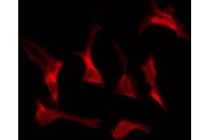 ABIN6274385 staining HepG2 by IF/ICC. (DOK7 anticorps  (C-Term))