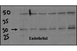 Endothelial cell lysate transferred to membrane was incubated with DSCR1 antibody at a 1:500 dilution. (RCAN1 anticorps  (AA 222-252))