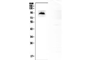 Western blot analysis of MDM2 using anti- MDM2 antibody . (MDM2 anticorps  (C-Term))